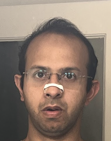File:Roshan Wearing Intake Breathing Strip.png