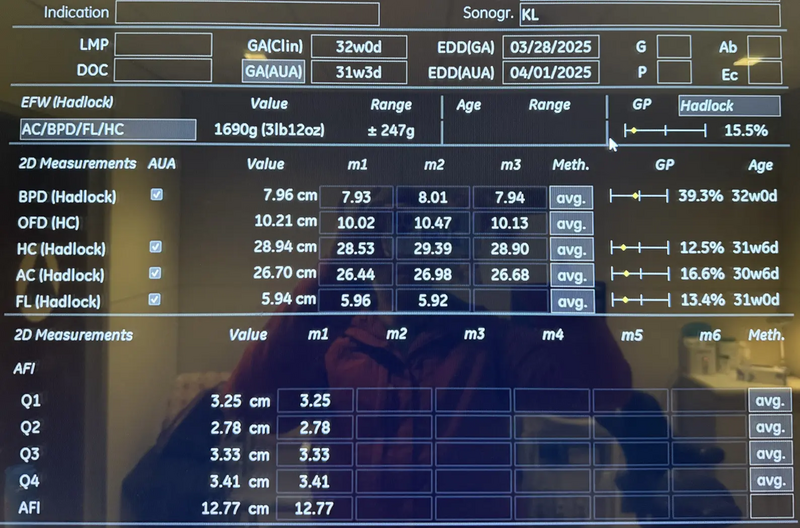 File:Ultrasound Baby Size Estimation - 32w.webp