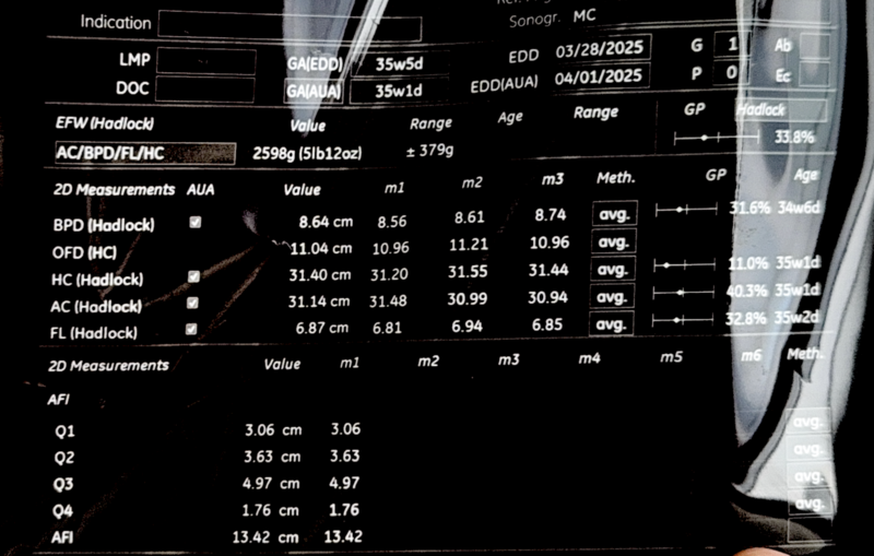 File:Ultrasound Baby Size Estimation.png